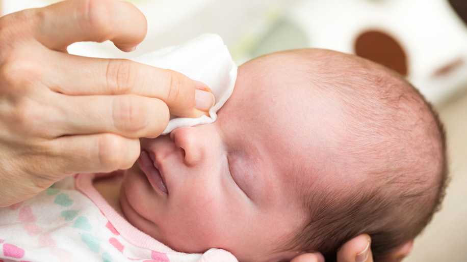 Bebeklerde Göz Şişmesi Neden Olur ve Ne İyi Gelir?