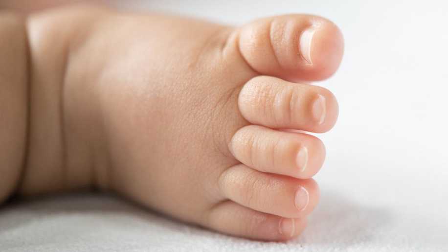 Bebeklerde Tırnak Batması Nasıl Geçer?