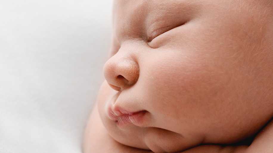 Bebeklerde Dudak Çatlaması ve Dudak Kuruluğu Neden Olur?