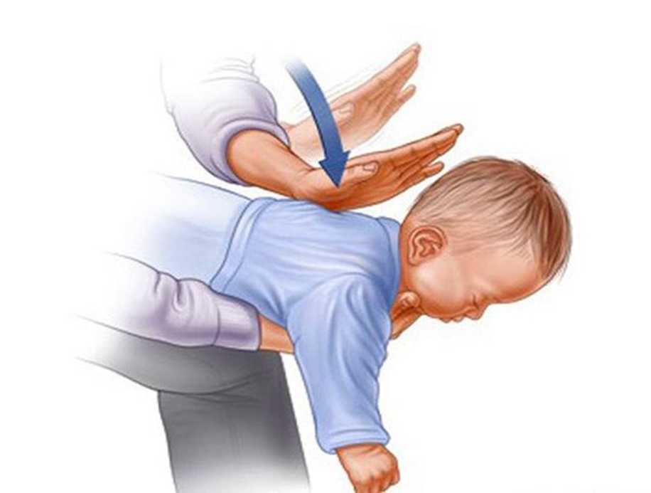 Bebeklerde Boğulma Belirtileri ve İlk Yardım Teknikleri