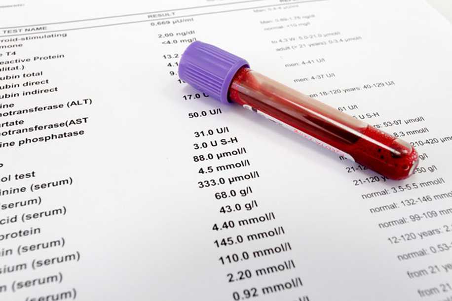 Beta HCG Değerleri Kan Testinde Kaç Çıkmalı?