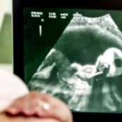 Hamilelikte Yapılan Ultrasonun Terimleri Ne Anlama Geliyor?