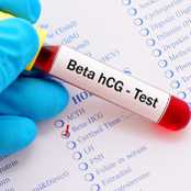 Beta HCG Hormonu Nedir?