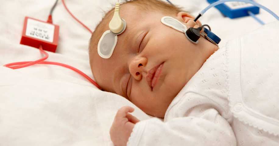 Yenidoğan Bebeklere Hangi Tarama Testleri Yapılır?