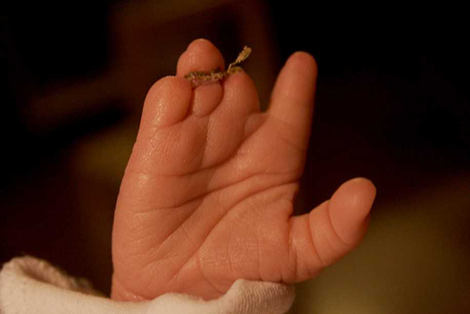 Ayağı Gelişmeyen Bebek Anne Karnında Ameliyat Edildi