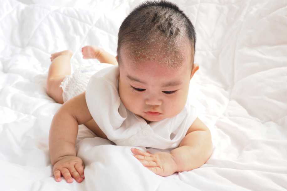 Yenidoğan Bebeğin Cilt Bakımında Annelerin Bilmesi Gereken 10 Detay