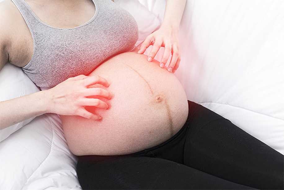 Hamilelikte Deri Döküntüsü Neden Olur?