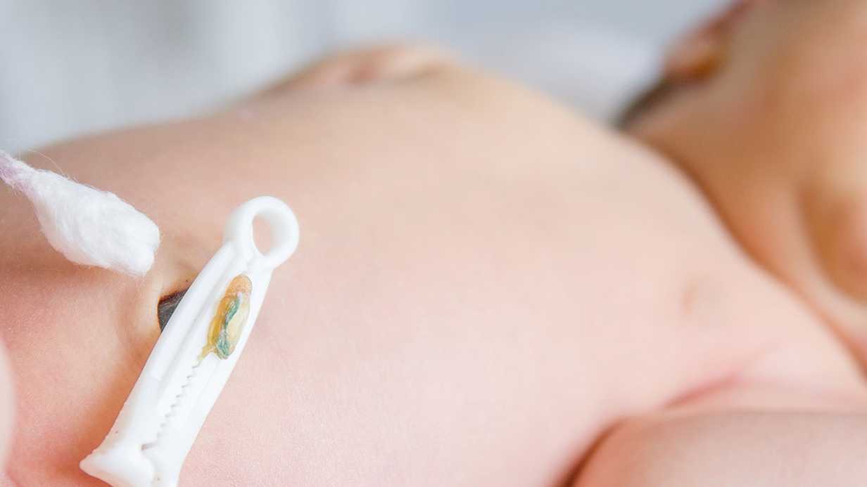 Bebeklerde Göbek Bağı Enfeksiyonu (Omfalit) Belirtileri, Nedenleri ve Tedavisi