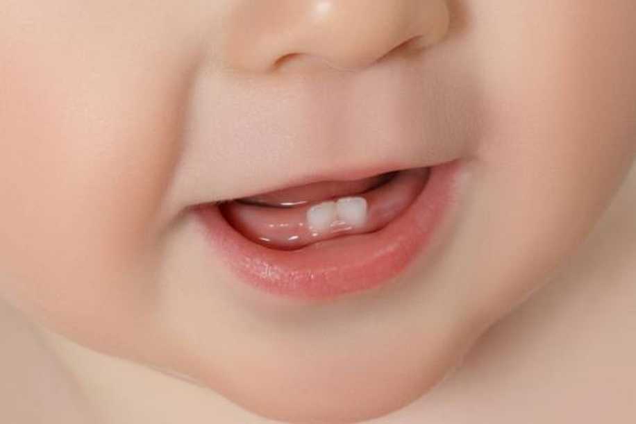 Bebeklerde Diş Çıkarma Sırası Nasıldır?