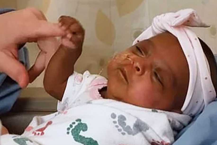 245 Gram Doğan Dünyanın En Küçük Bebeği Hayata Tutundu!