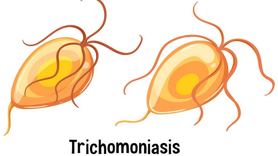 Gebelikte Trikomonas: Belirtileri, Nedenleri ve Tedavisi