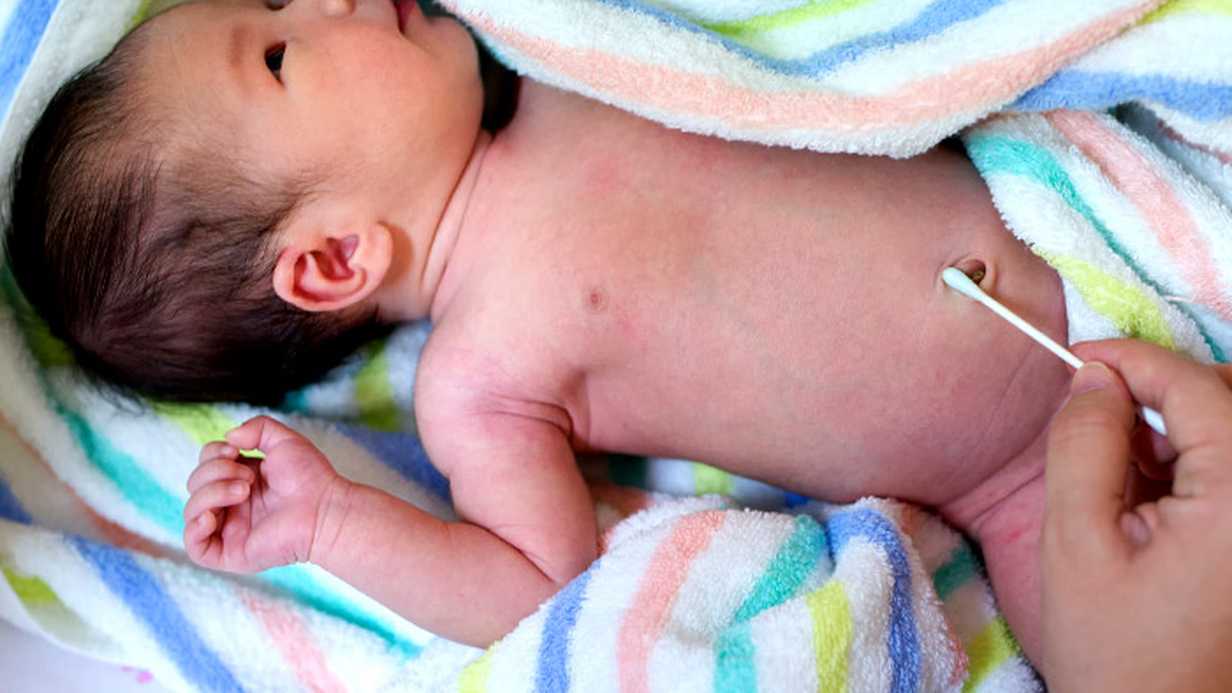 Bebeğinizde Göbek Fıtığı Varsa Neler Yapmalısınız?