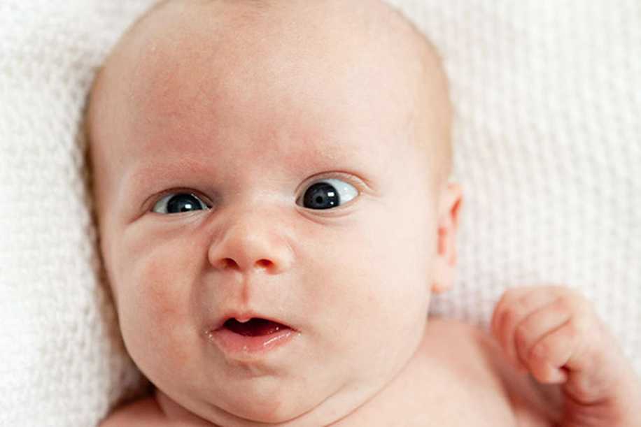 Yenidoğan Bebeklerde Şaşılık (Göz Kayması) Neden Olur?