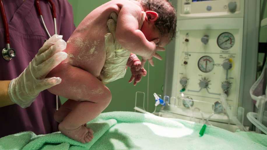 Sezaryenin Nadir Karşılaşılan Komplikasyonu: Doğum Sonrası Fıtık