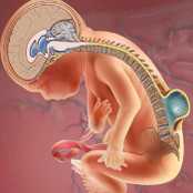 Meningomiyelosel Nedir?
