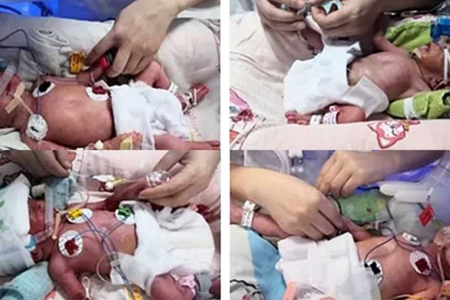 Çin’de Mucize Doğum: Üç Düşüğün Ardından Dördüz Doğurdu